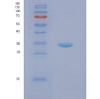 人核仁磷酸蛋白(NPM1)重组蛋白