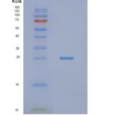 人线粒体-5'-核苷酸酶(NT5M)重组蛋白