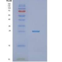 人线粒体-5'-核苷酸酶(NT5M)重组蛋白