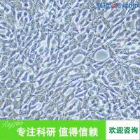 NCI-H716人结直肠腺癌细胞112