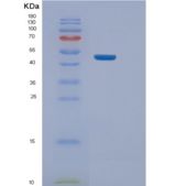 人NELFE重组蛋白
