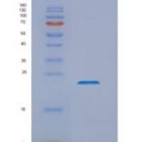 人NKIRAS1重组蛋白