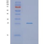 人非同源末端加入因子(NHEJ1)重组蛋白