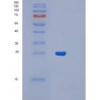 人肌球蛋白轻链6B(MYL6B)重组蛋白