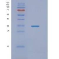 人NEURL2重组蛋白