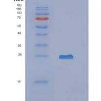 人神经钙蛋白δ(NCALd)重组蛋白