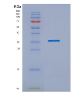 人NUBP1重组蛋白