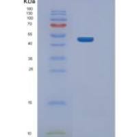 人Nei内切核酸酶Ⅷ样蛋白1(NEIL1)重组蛋白