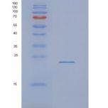 人NDUFAF4重组蛋白