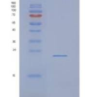 人NDUFAF4重组蛋白