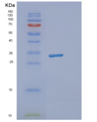 人NCEH1重组蛋白