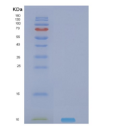 人神经调节素4(NRG4)重组蛋白