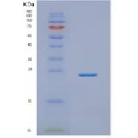 人NKIRAS2重组蛋白