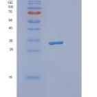 人NCEH1重组蛋白