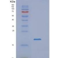 人NCBP2重组蛋白