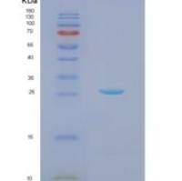 人核仁磷酸蛋白2(NPM2)重组蛋白