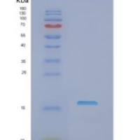 人非转移细胞2表达NM23A蛋白(NME2)重组蛋白
