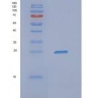人NEUROG3重组蛋白