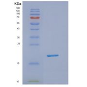人NUDT1重组蛋白
