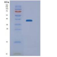 人NEIL2重组蛋白