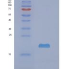 人非转移细胞3表达NM23A蛋白(NME3)重组蛋白
