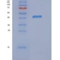 人N-myc下游调节基因3(NDRG3)重组蛋白