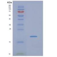 人非转移细胞4表达NM23A蛋白(NME4)重组蛋白