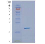 人NUDT1重组蛋白