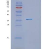 人尼克酰胺-N-甲基转移酶(NNMT)重组蛋白