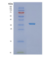人NT5C3B重组蛋白