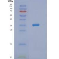 人NMNAT2重组蛋白