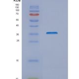 人NUBP1重组蛋白