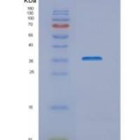 人NUBP1重组蛋白