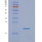 人非转移细胞1表达NM23A蛋白(NME1)重组蛋白