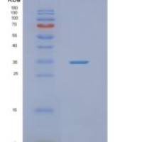 人NFKBID重组蛋白