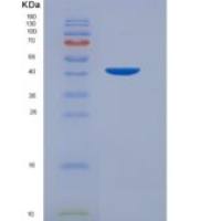 人天冬酰tRNA合成酶(NARS)重组蛋白