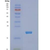 大肠杆菌NDK重组蛋白