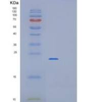 人肌球蛋白轻链9(MYL9)重组蛋白