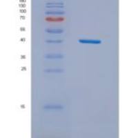 人核分布基因C同源物(NUDC)重组蛋白