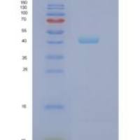 人嗜中性粒细胞胞浆因子1(NCF1)重组蛋白