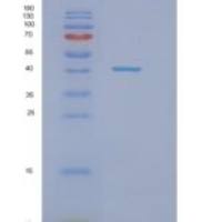 人NAA30重组蛋白
