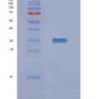 人NMRAL1重组蛋白