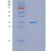 人N-乙基马来酰亚胺敏感因子附着蛋白α(NAPa)重组蛋白