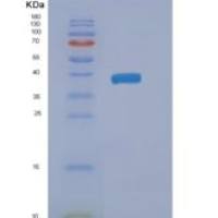 人NAIF1重组蛋白