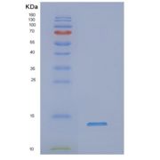 人NADH脱氢酶【泛醌】1α亚复合物亚单位2重组蛋白