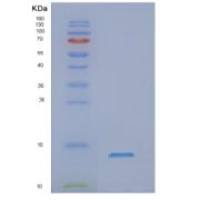 人NADH脱氢酶【泛醌】1α亚复合物亚单位2重组蛋白
