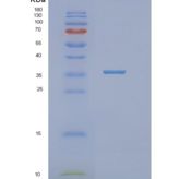 人NTHL1重组蛋白