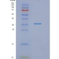 人NTHL1重组蛋白