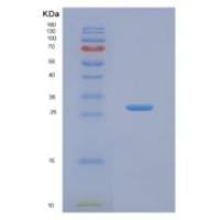 人NABP1重组蛋白