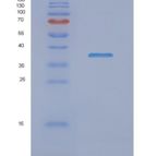 人NDUFAF1重组蛋白